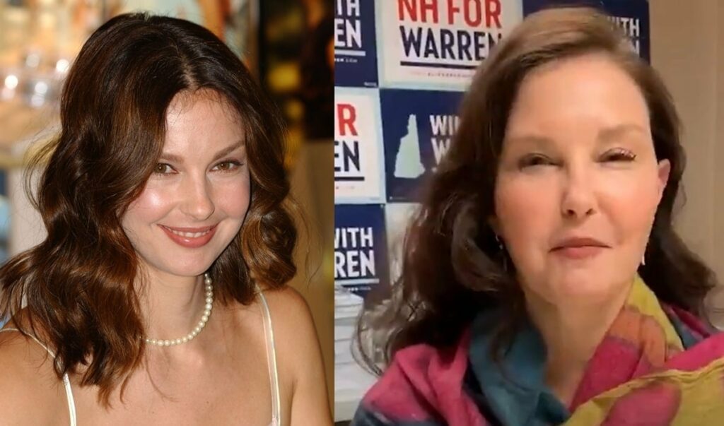 Ashley Judd Face accident Before After